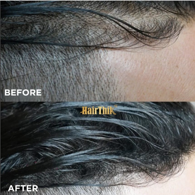 SUPREME PREMIUM HAIR BUILDING FIBERS - Image 6